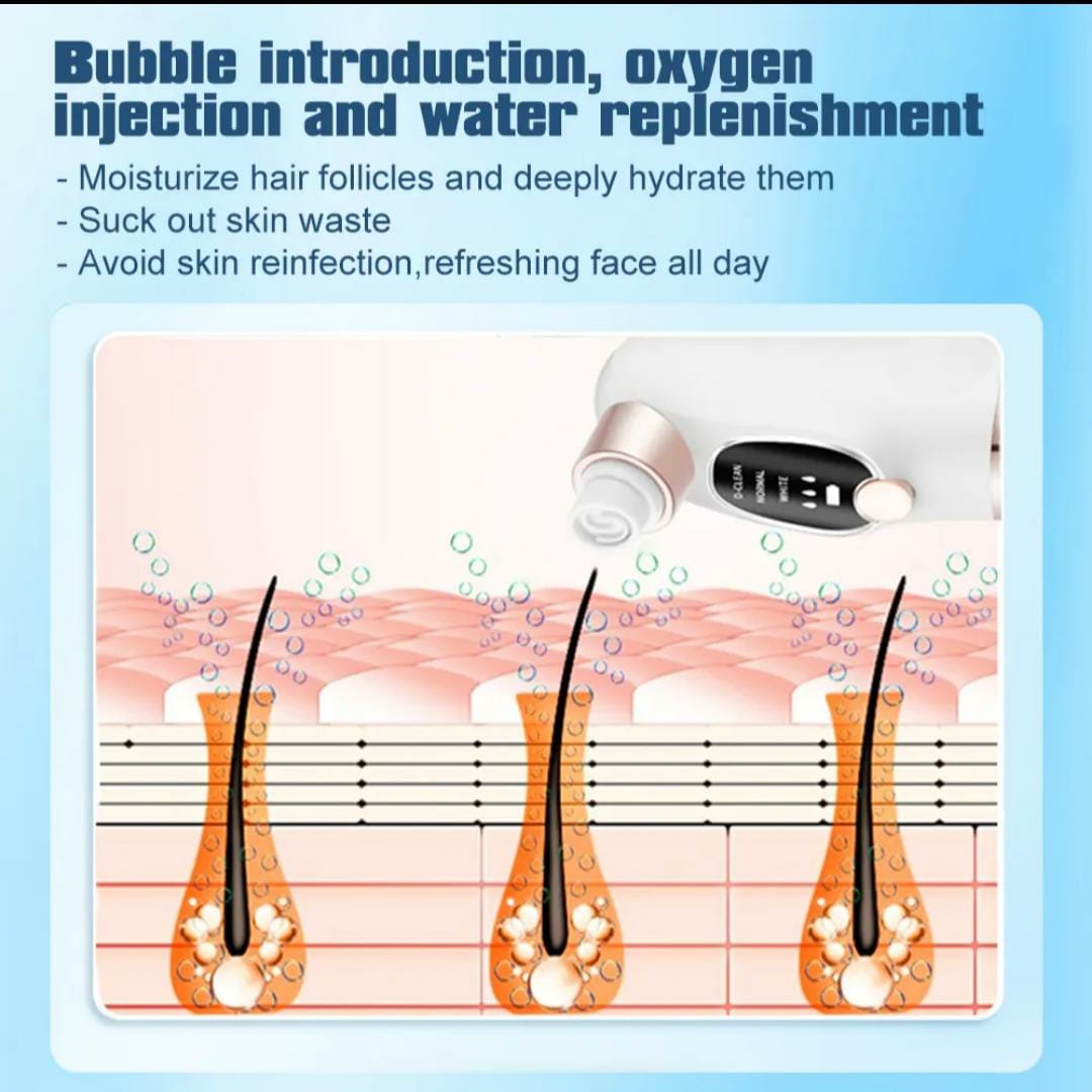 Super Micro Bubble Beauty Blackhead Remover